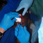 Medical team performing ear surgery